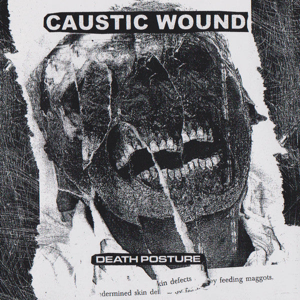 CAUSTIC WOUND - DEATH POSTURE