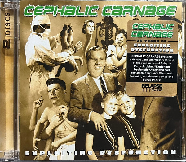 CEPHALIC CARNAGE - EXPLOITING DYSFUNCTION (DELUXE/25TH ANNIVERSARY/REISSUE) (2CD)